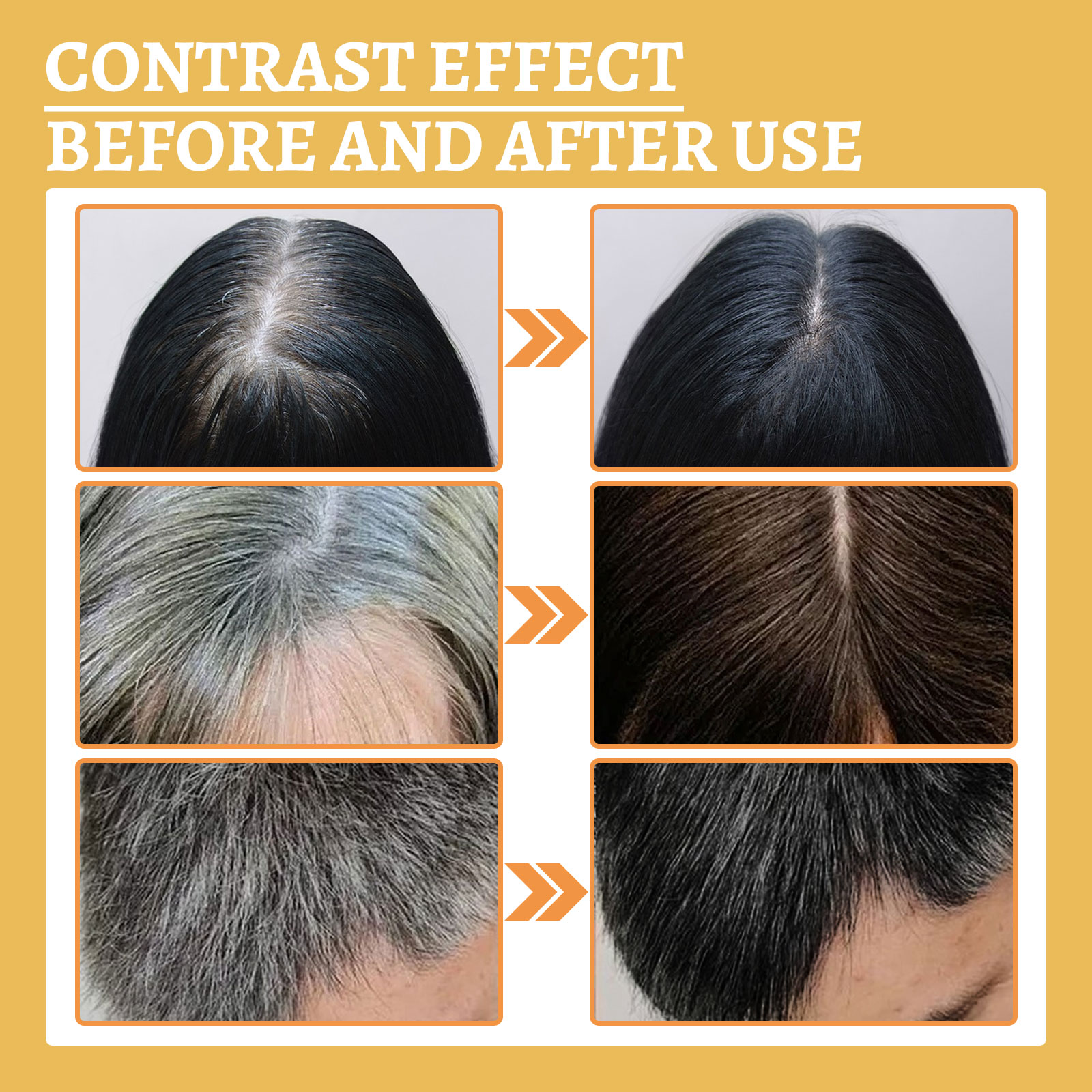 Black Ganoderma Lucidum Hair L - Root Stimulator Liquid 리뷰 및 가격