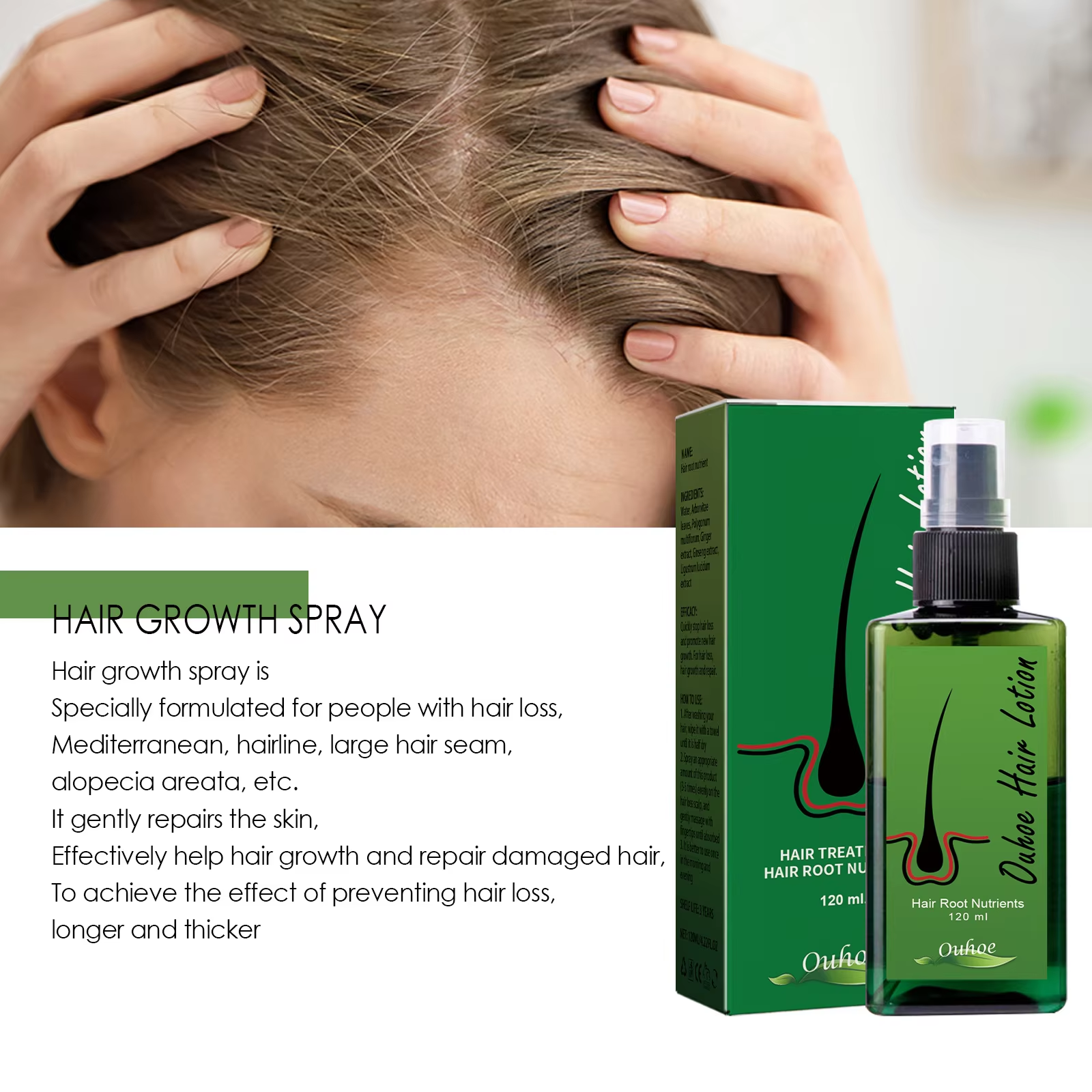 Hair Growth Spray Anti Hair Lo - Root Stimulator Liquid 리뷰 및 가격
