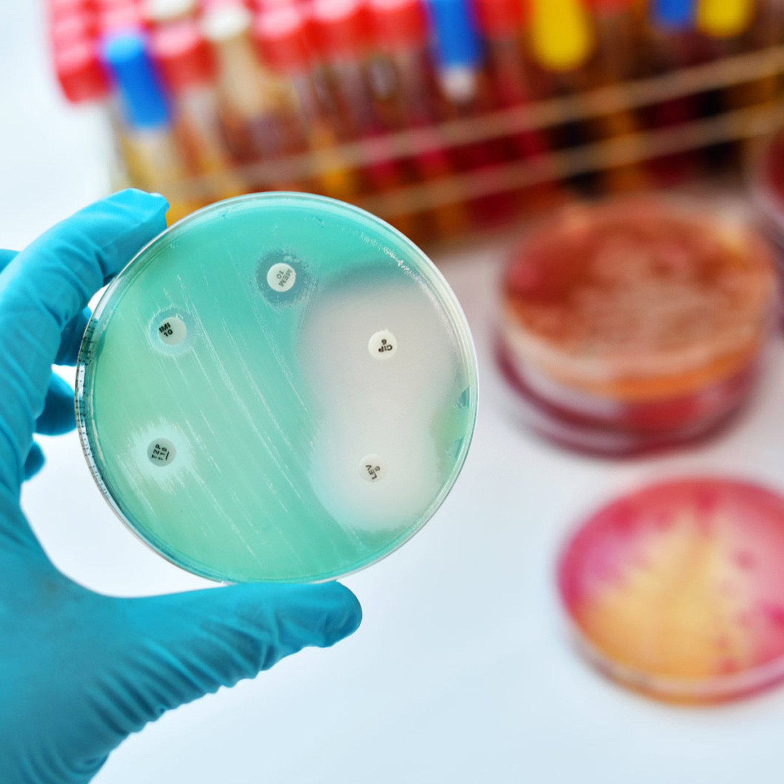30Pcs Petri Dishes Plastic Cle - Agar Tissue Culture 리뷰 및 가격